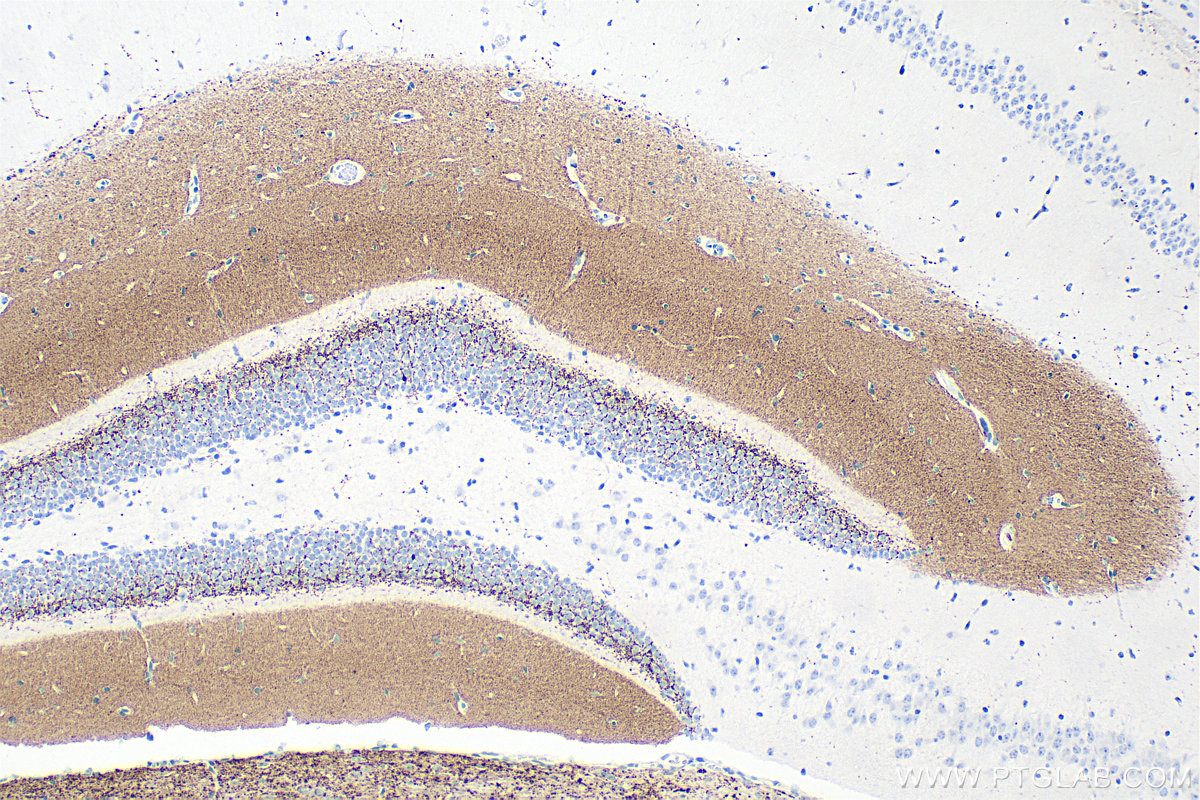 IHC staining of mouse brain using 84083-2-RR