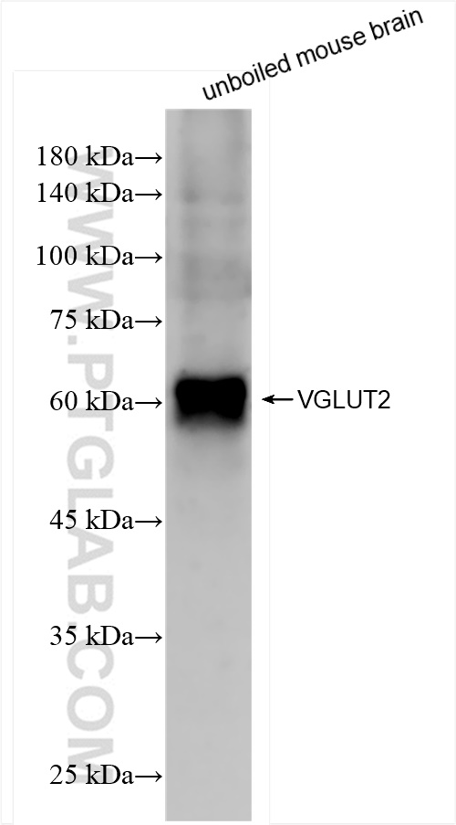 WB analysis of mouse brain using 84083-2-RR WB analysis of mouse brain using 84083-2-RR