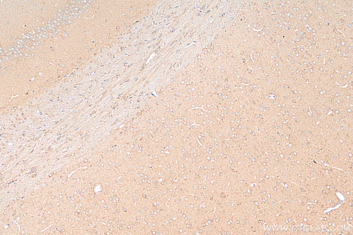 IHC staining of rat brain using 55491-1-AP