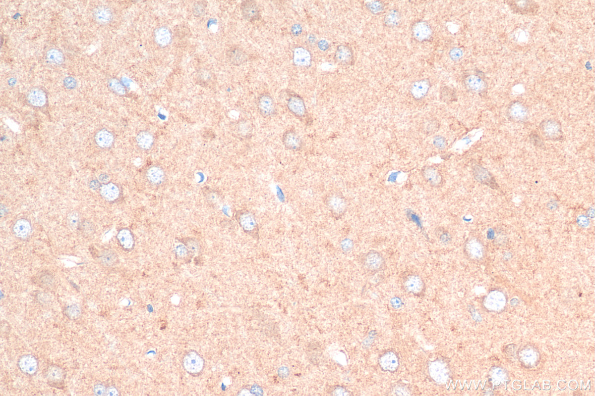 IHC staining of rat brain using 55491-1-AP