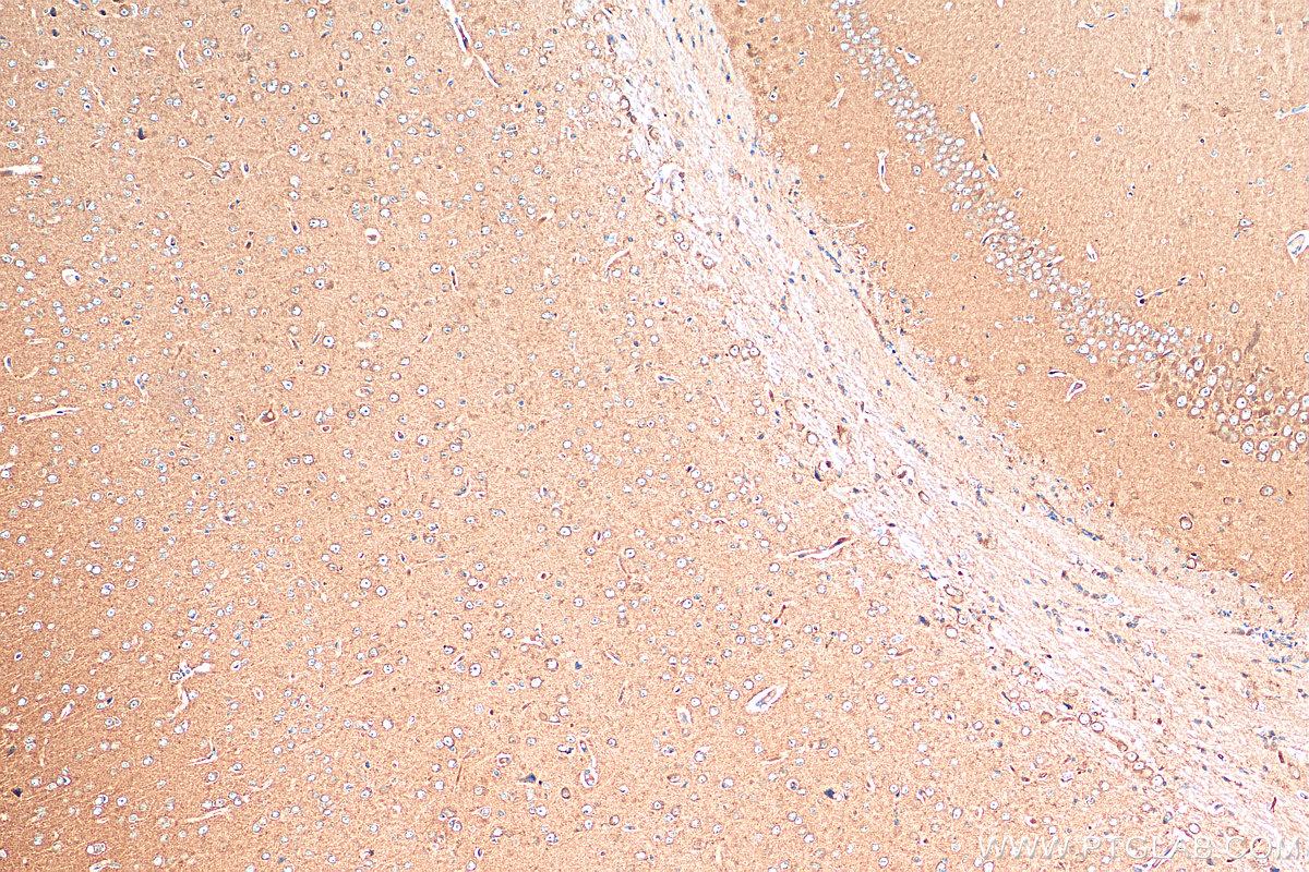 IHC staining of mouse brain using 55491-1-AP