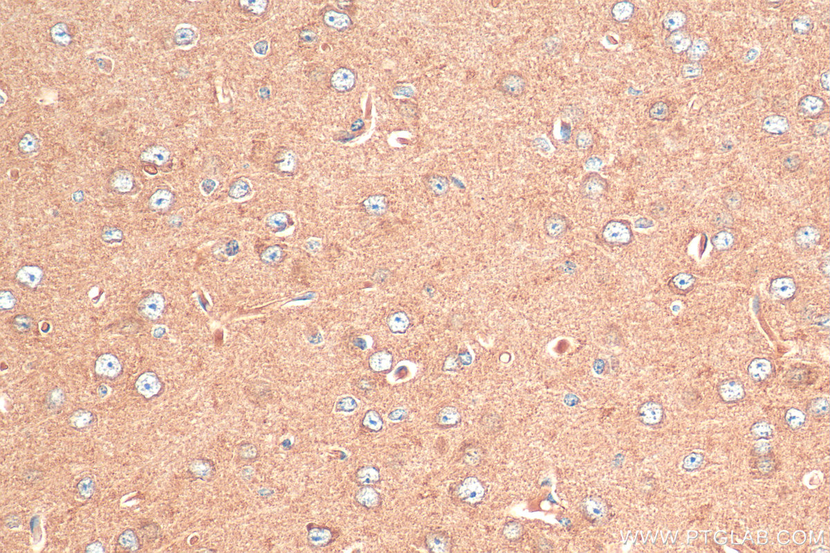 IHC staining of mouse brain using 55491-1-AP