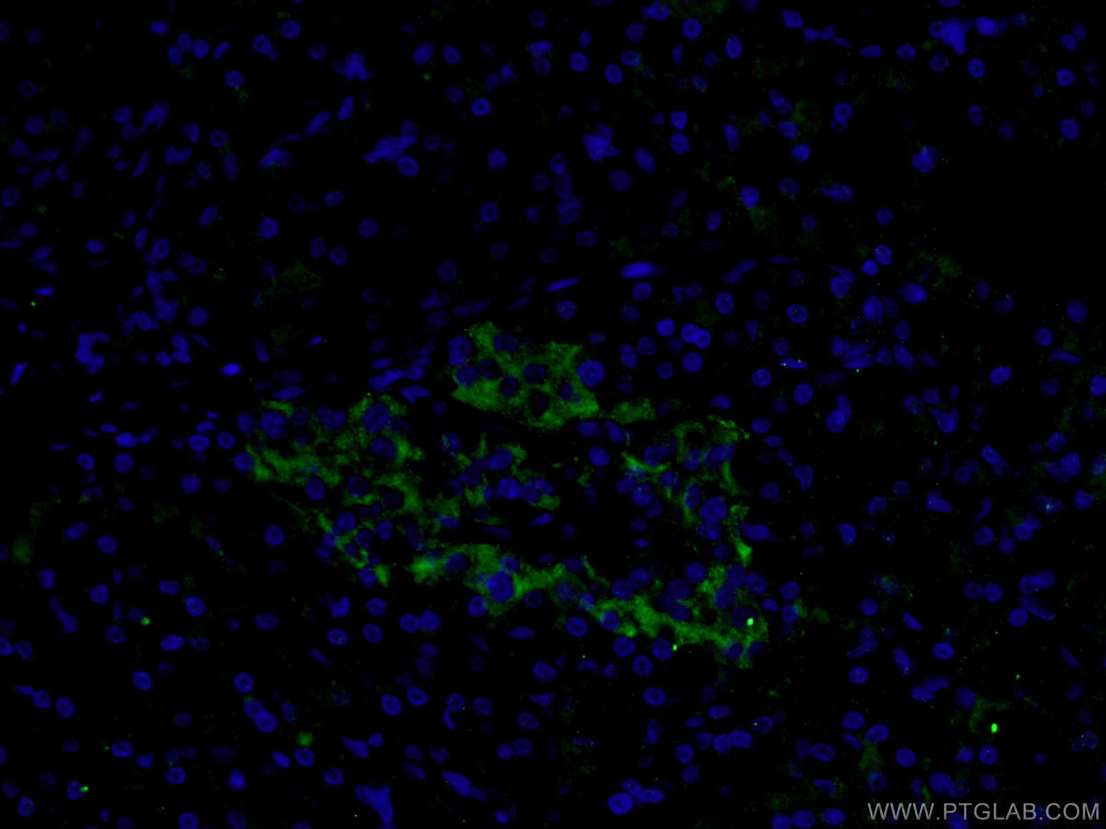 IF Staining of human pancreas using 26731-1-AP