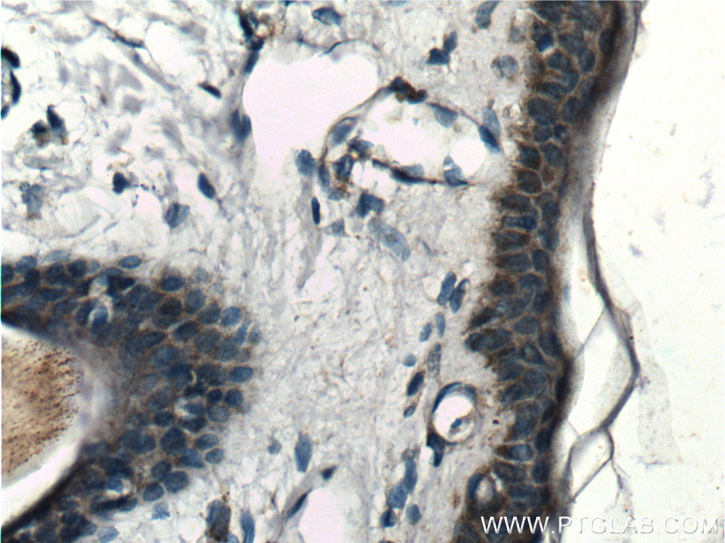 IHC staining of human skin using 26731-1-AP