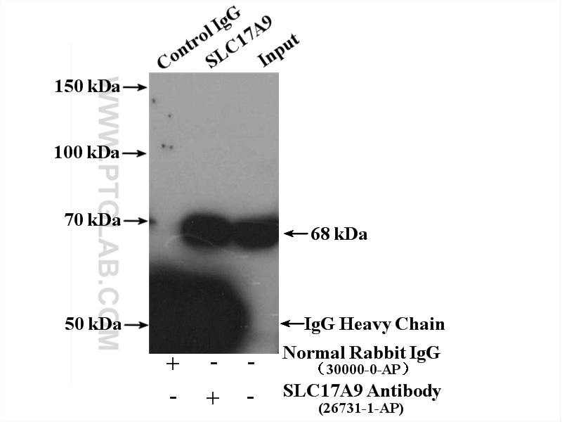 IP experiment of mouse brain using 26731-1-AP