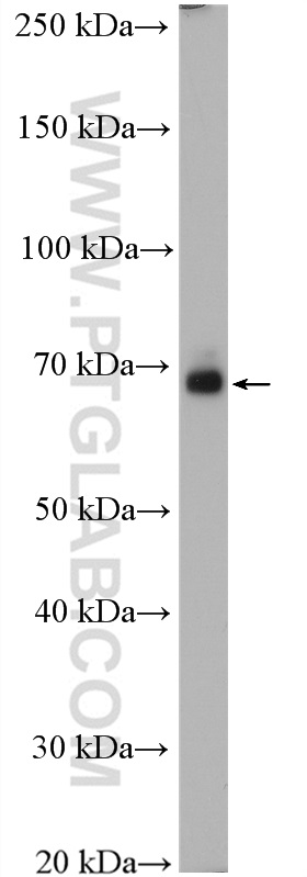 SLC17A9