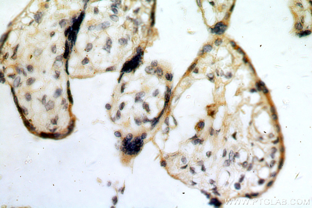 IHC staining of human placenta using 20340-1-AP