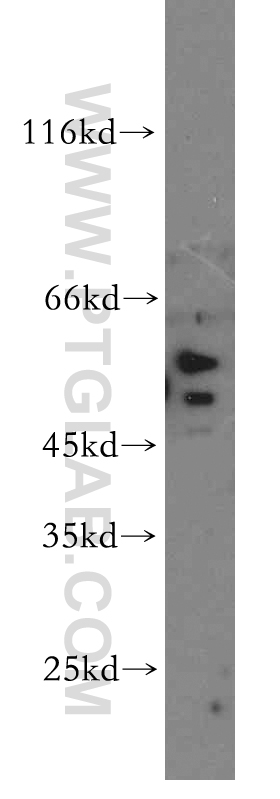 WB analysis of HEK-293 using 20340-1-AP