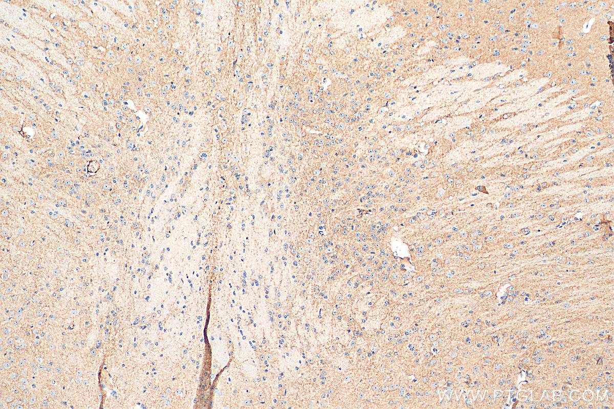 IHC staining of mouse brain using 12686-1-AP