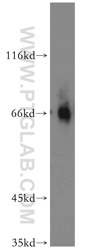 WB analysis of mouse ovary using 12686-1-AP