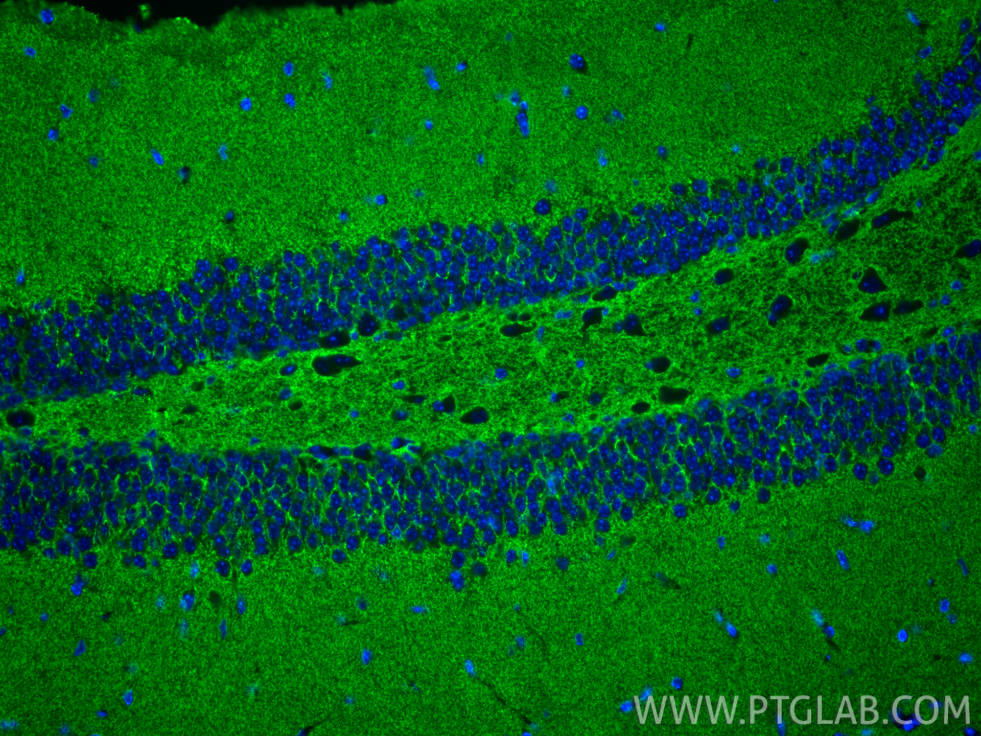 Immunofluorescent analysis of (4% PFA) fixed paraffin-embedded mouse brain tissue using EAAT2 antibody (22515-1-AP) at dilution of 1:200 and CoraLite®488-Conjugated Goat Anti-Rabbit IgG(H+L) (<a class='green' href='/productredirect?CatalogNo=SA00013-2' target='_blank'>SA00013-2</a>). Heat mediated antigen retrieval with Tris-EDTA buffer (pH 9.0). IF Staining of mouse brain using 22515-1-AP