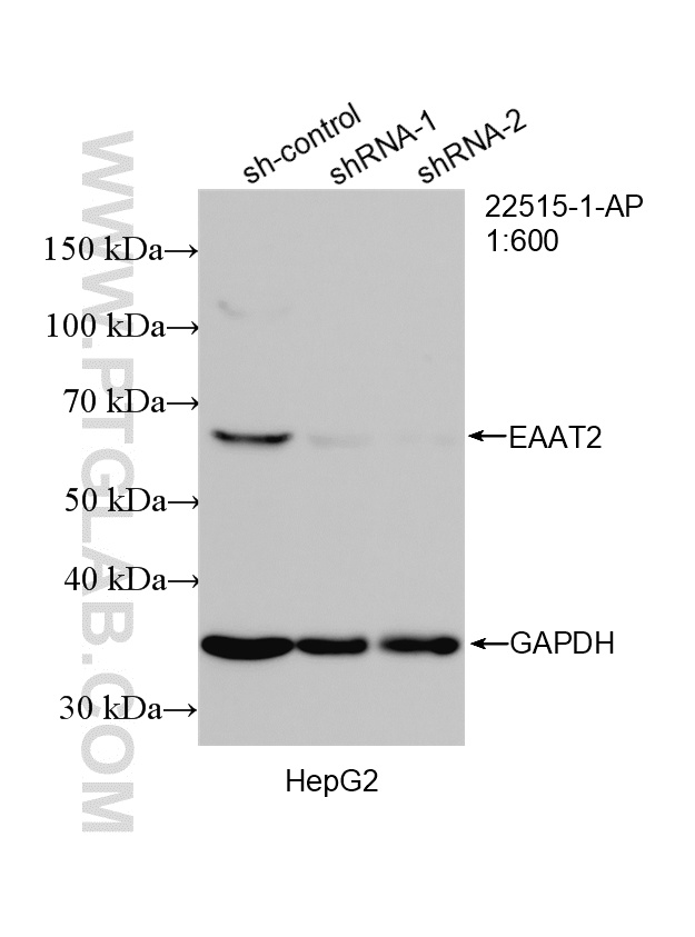 WB analysis of HepG2 using 22515-1-AP