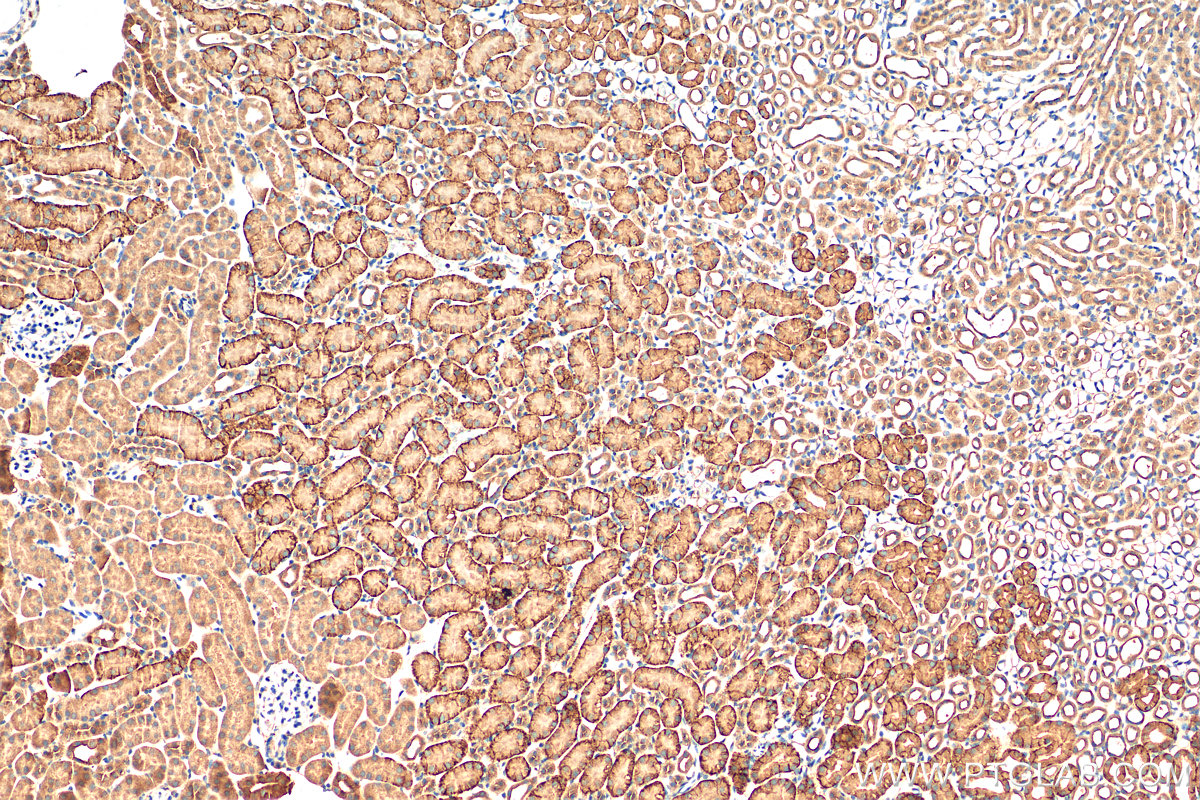 IHC staining of mouse kidney using 13067-2-AP