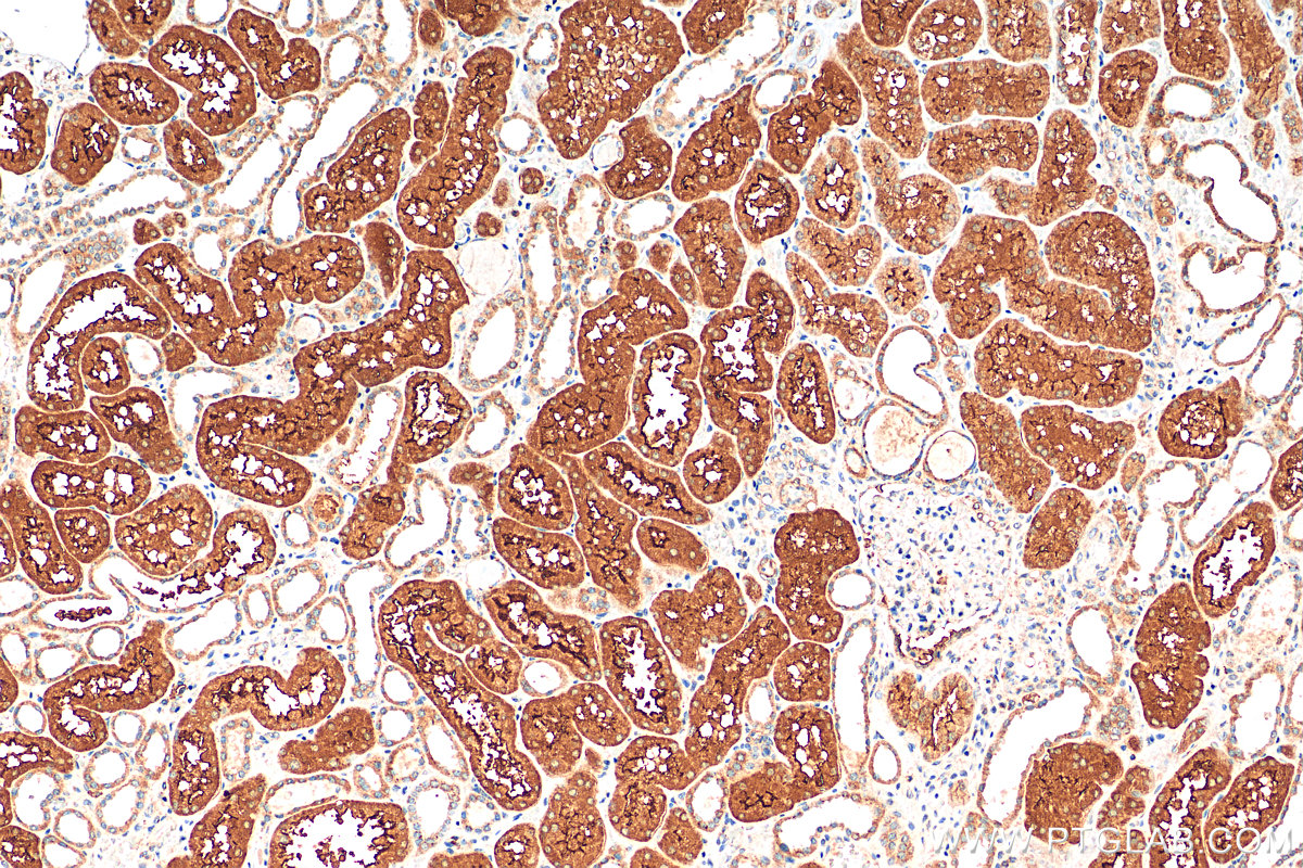 IHC staining of human kidney using 13067-2-AP