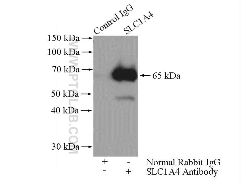 IP experiment of mouse brain using 13067-2-AP