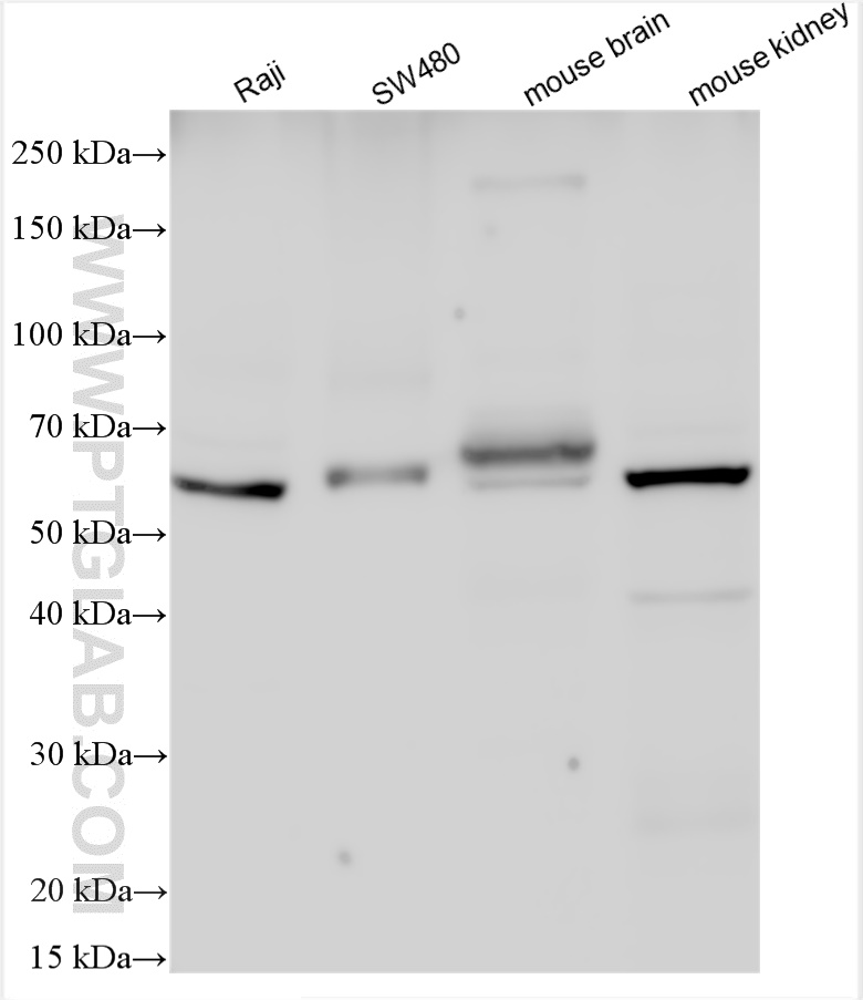 WB analysis using 13067-2-AP