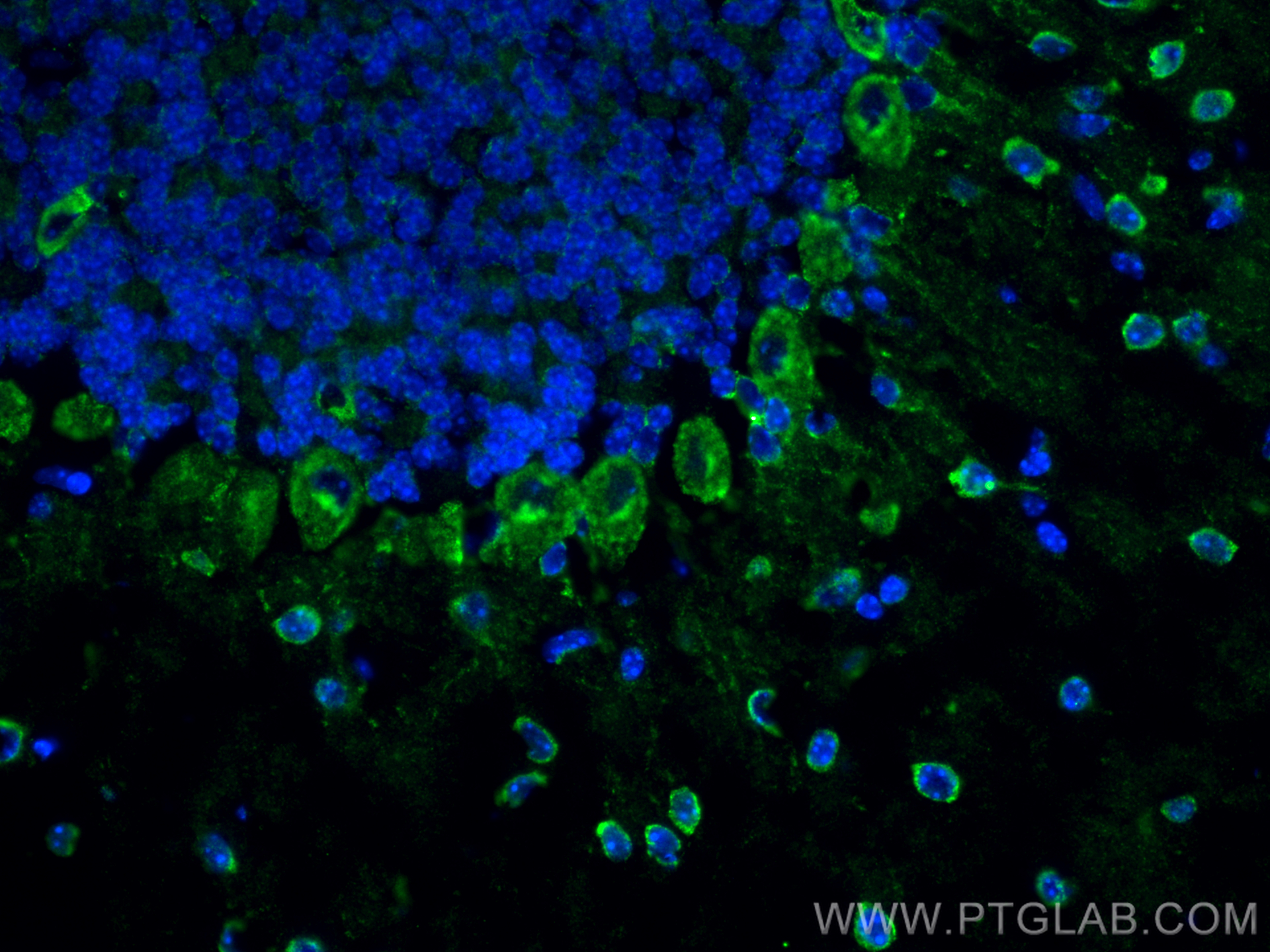 IF Staining of mouse cerebellum using 12876-1-AP