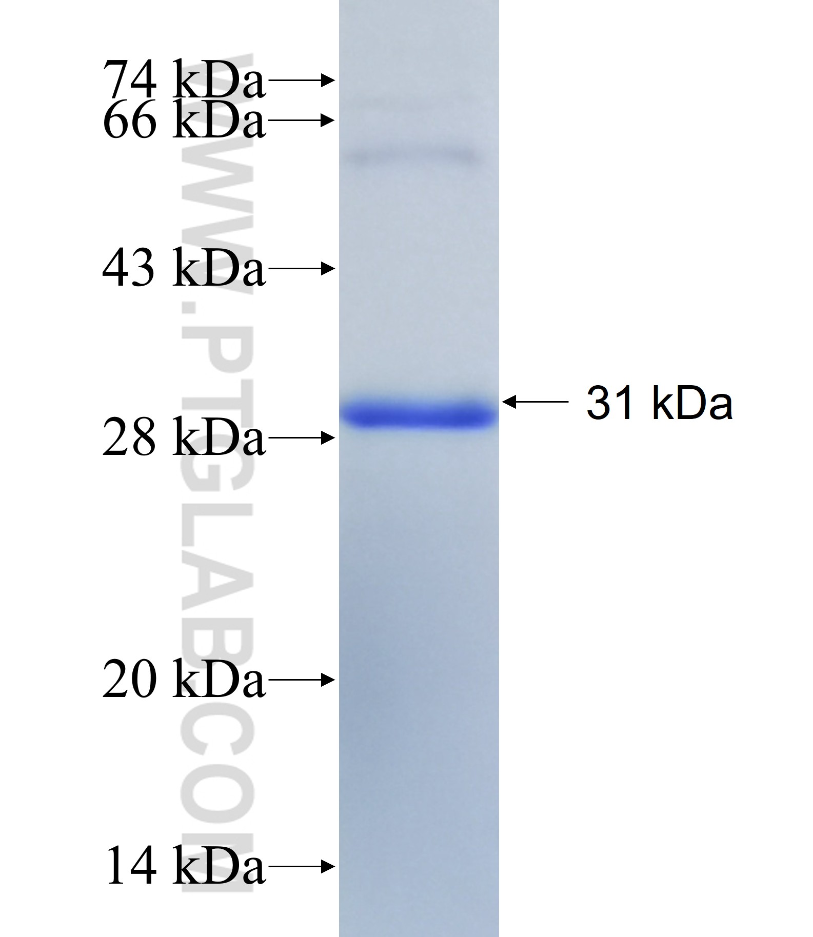 SLC20A1 fusion protein Ag31488 SDS-PAGE