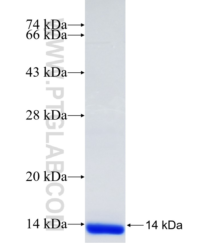 SLC22A10 fusion protein Ag34558 SDS-PAGE