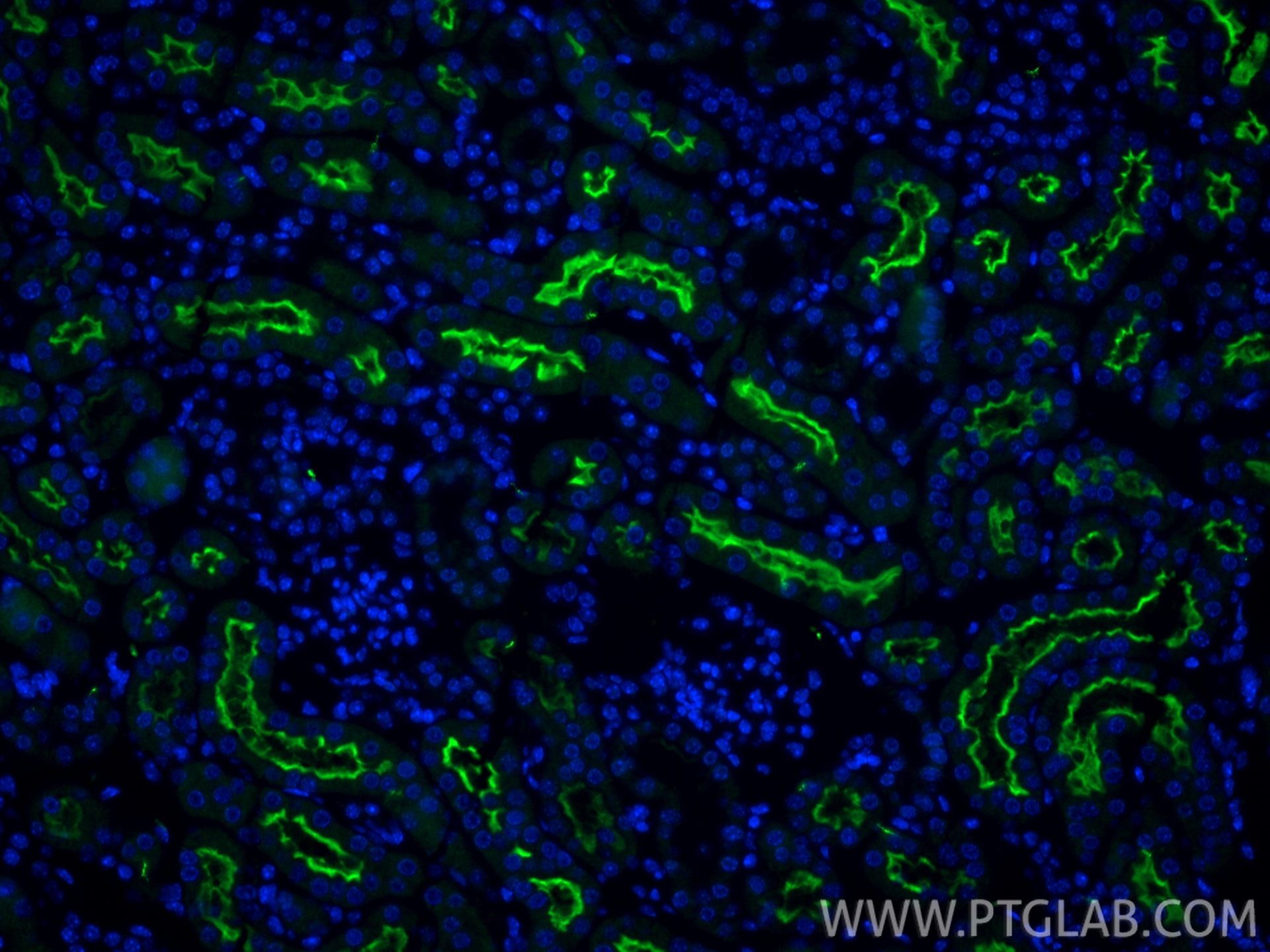 IF Staining of mouse kidney using 14937-1-AP IF Staining of mouse kidney using 14937-1-AP