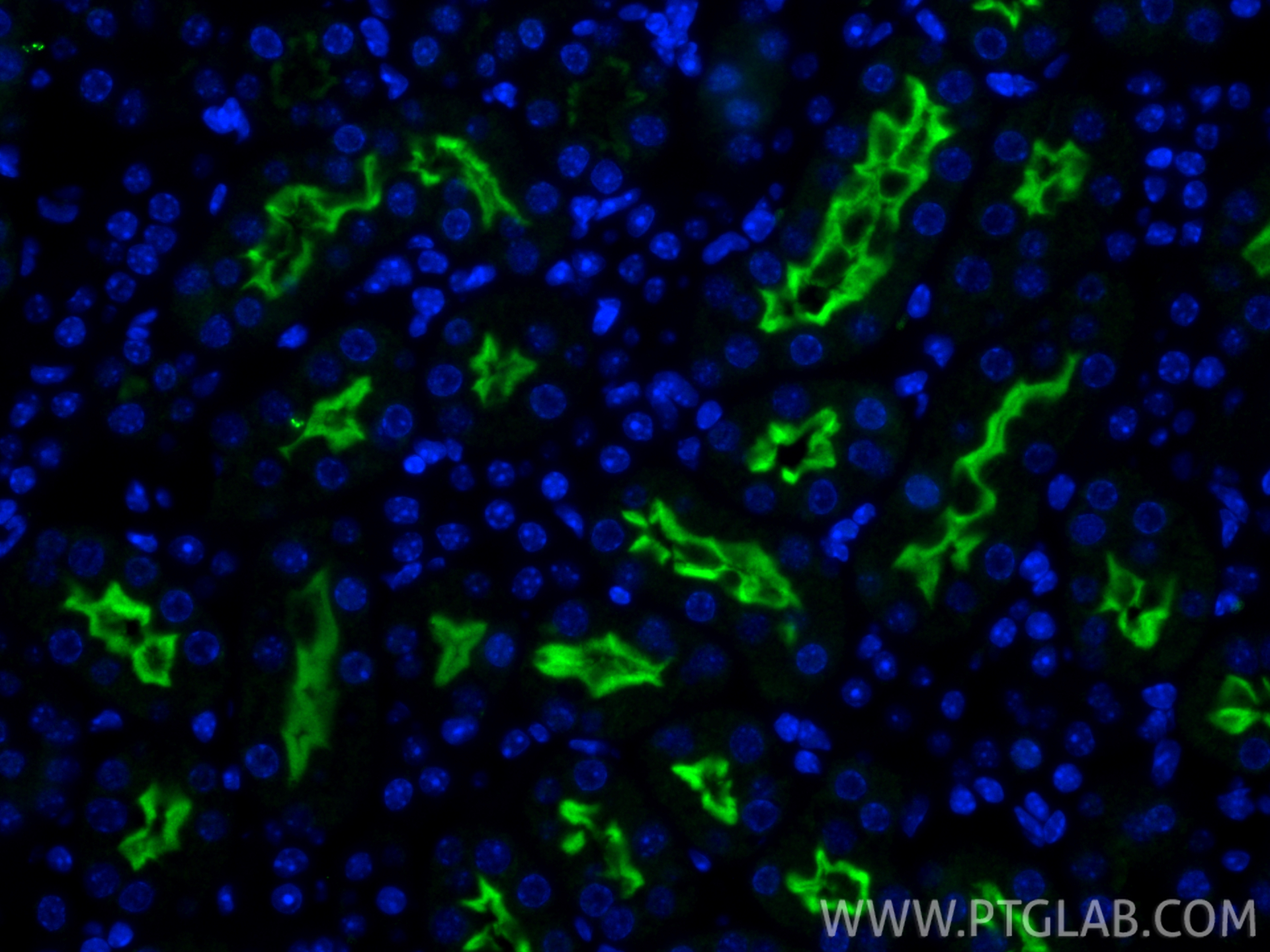 IF Staining of mouse kidney using 14937-1-AP IF Staining of mouse kidney using 14937-1-AP