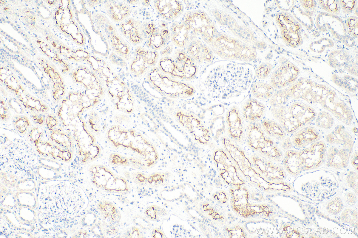 IHC staining of human kidney using 14937-1-AP (same clone as 14937-1-PBS)