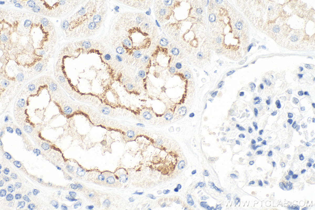 IHC staining of human kidney using 14937-1-AP (same clone as 14937-1-PBS)