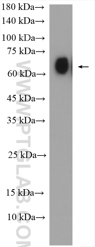 SLC22A14