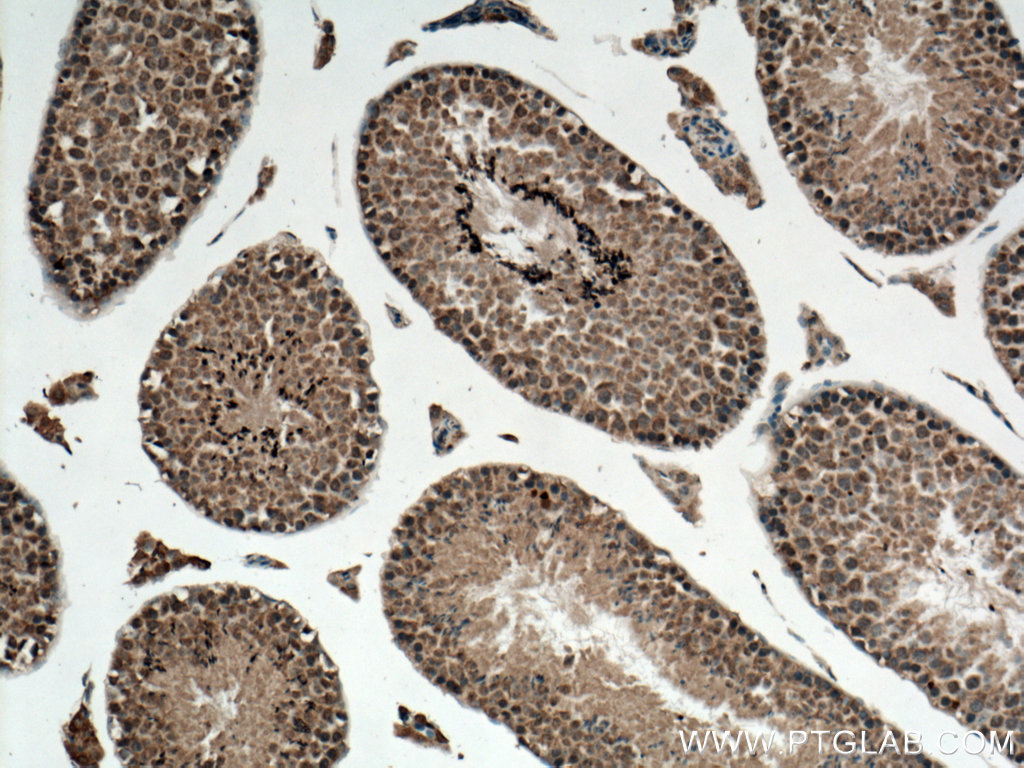 IHC staining of mouse testis using 28343-1-AP