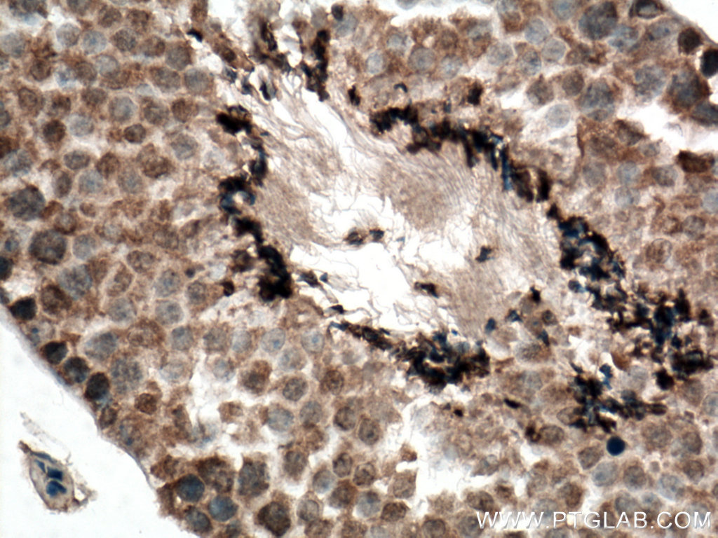 IHC staining of mouse testis using 28343-1-AP