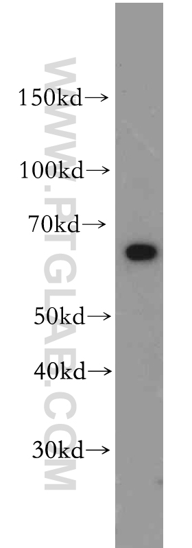 SLC22A15 Polyclonal antibody