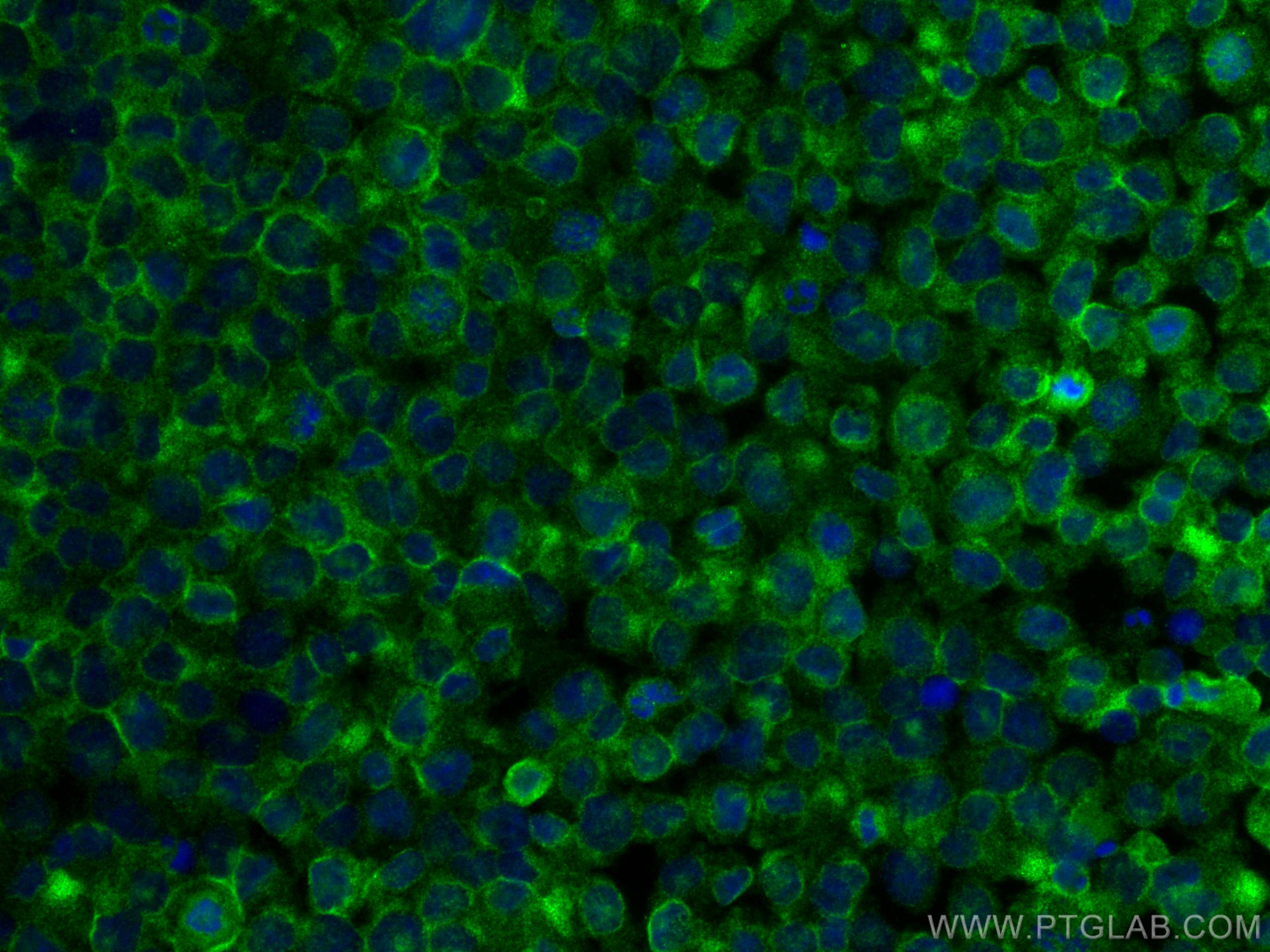 IF Staining of THP-1 using 26833-1-AP