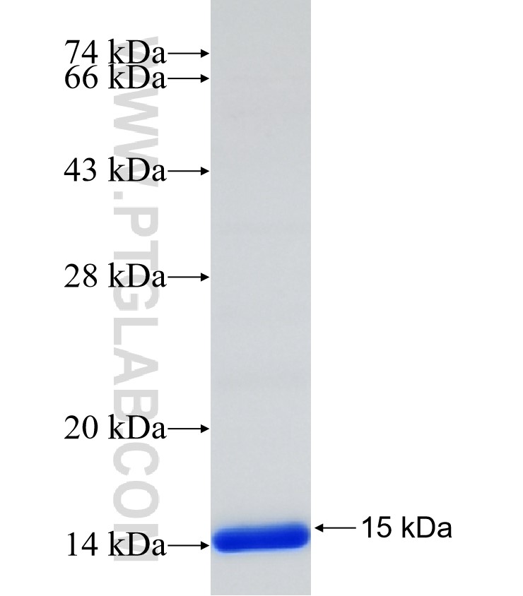 SLC22A2 fusion protein Ag31271 SDS-PAGE