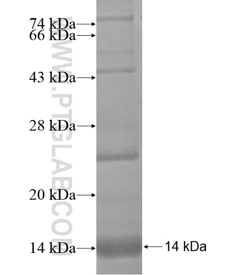 SLC22A23 fusion protein Ag19036 SDS-PAGE
