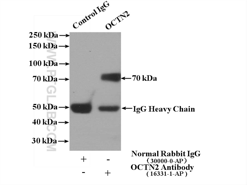 IP experiment of mouse skeletal muscle using 16331-1-AP