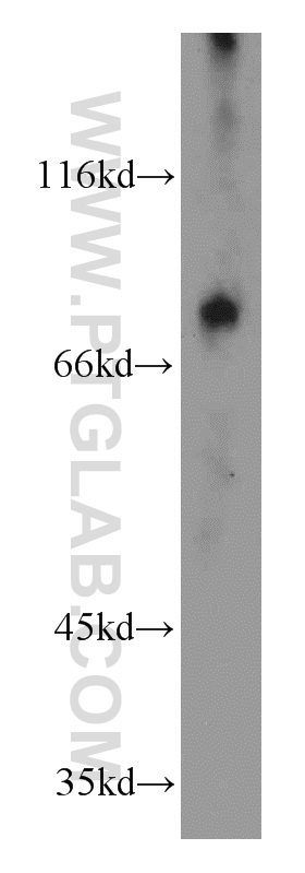 WB analysis of mouse small intestine using 16331-1-AP