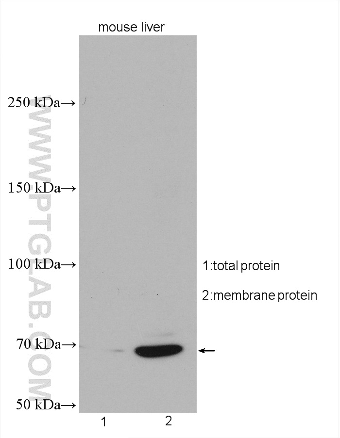 mouse liver tissue were subjected to SDS PAGE followed by western blot with 27998-1-AP (SLC22A9 antibody) at dilution of 1:3000 incubated at room temperature for 1.5 hours. WB analysis of mouse liver using 27998-1-AP