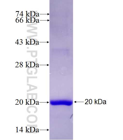 SLC22A9 fusion protein Ag27584 SDS-PAGE SLC22A9 fusion protein Ag27584 SDS-PAGE