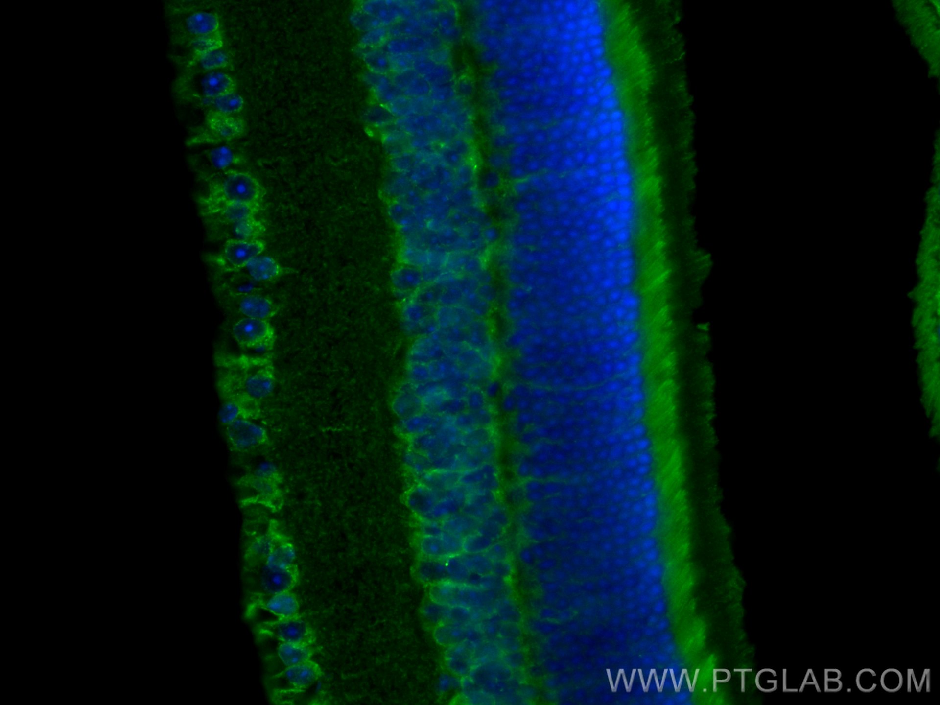 IF Staining of mouse eye using 18992-1-AP