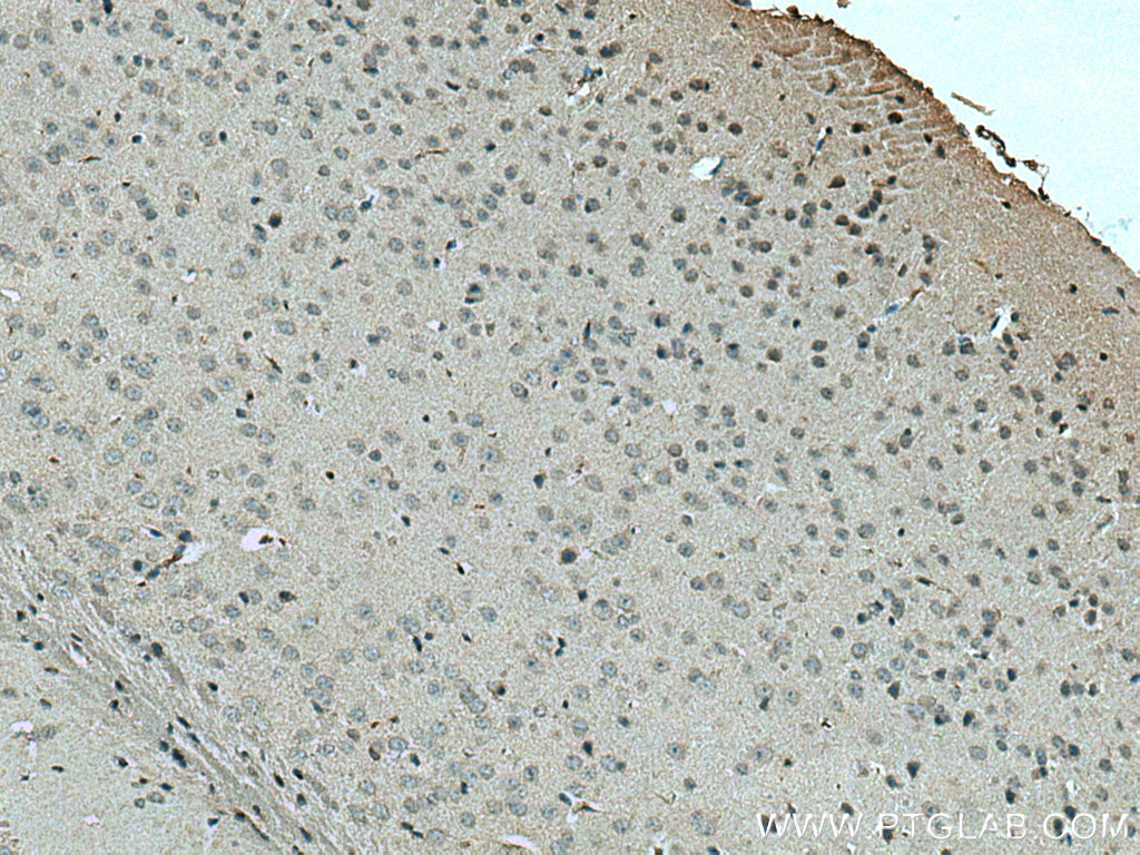 IHC staining of mouse brain using 21430-1-AP