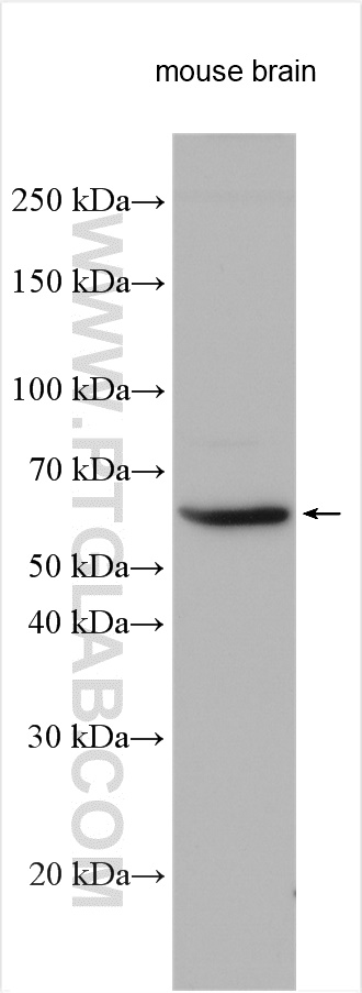 WB analysis using 21430-1-AP