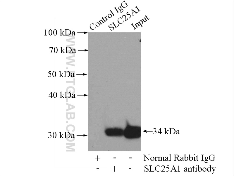 IP experiment of HeLa using 15235-1-AP