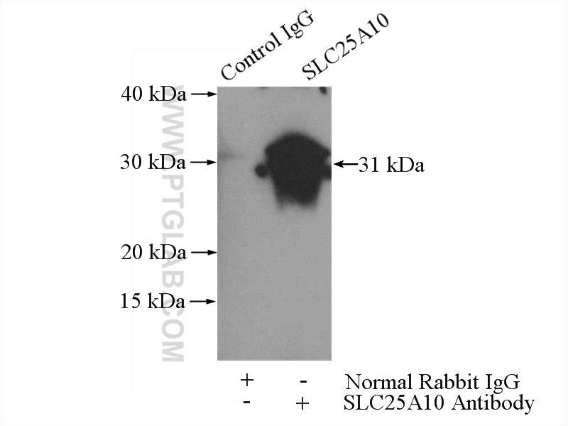 IP experiment of mouse liver using 12086-1-AP