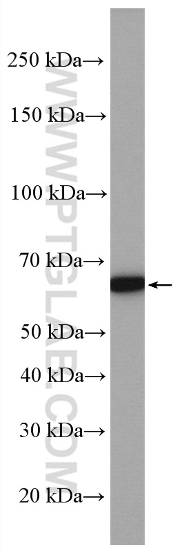 WB analysis of mouse skeletal muscle using 26804-1-AP