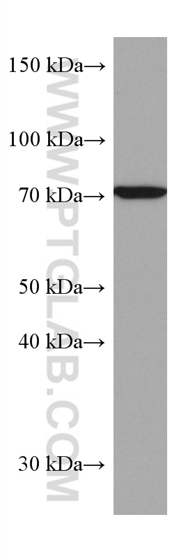 WB analysis of LNCaP using 67467-1-Ig