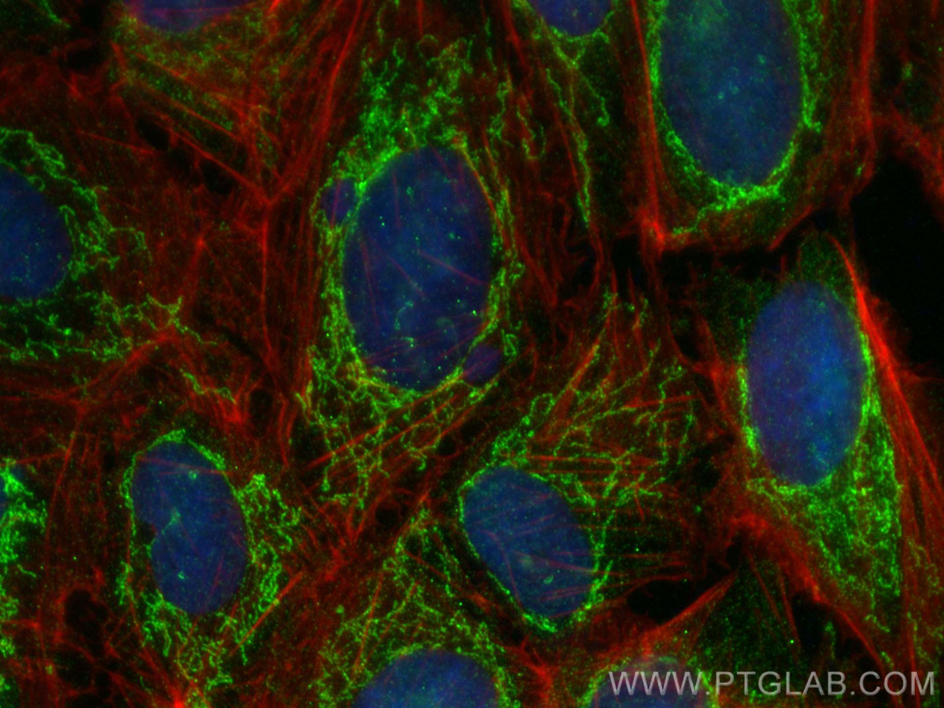 IF Staining of U2OS using 10789-1-AP