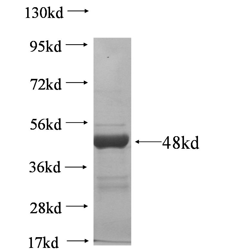 SLC25A13 fusion protein Ag5875 SDS-PAGE