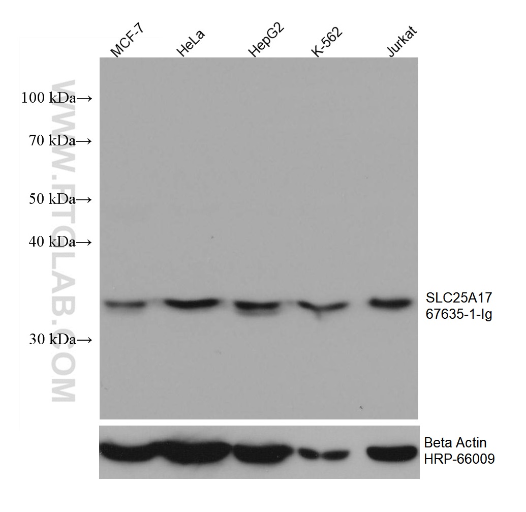 WB analysis using 67635-1-Ig