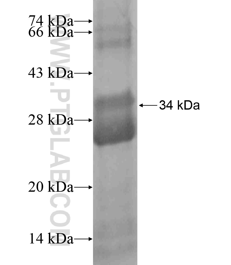 SLC25A17 fusion protein Ag18118 SDS-PAGE SLC25A17 fusion protein Ag18118 SDS-PAGE