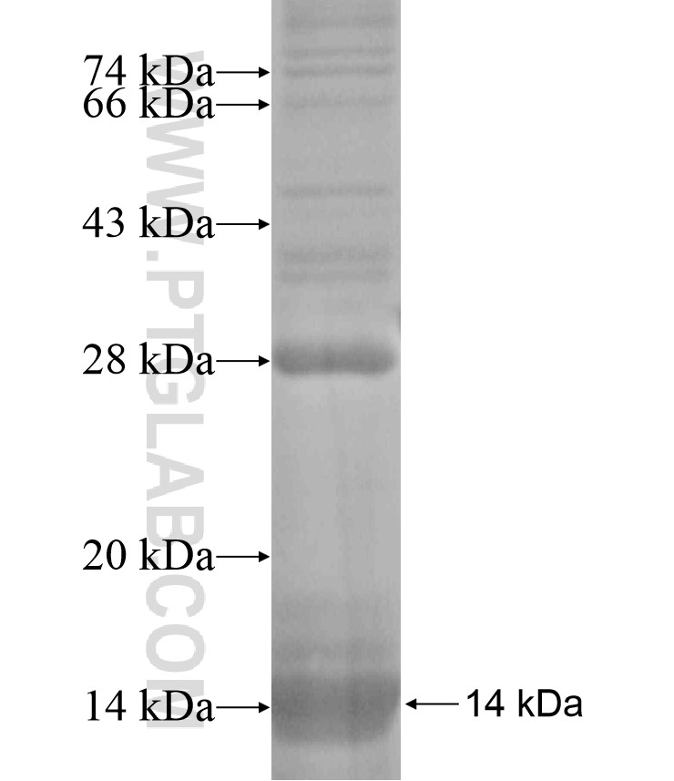 SLC25A17 fusion protein Ag18171 SDS-PAGE SLC25A17 fusion protein Ag18171 SDS-PAGE